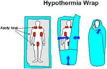 Hypothermia Wrap